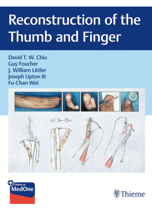 Reconstruction of the Thumb and Finger