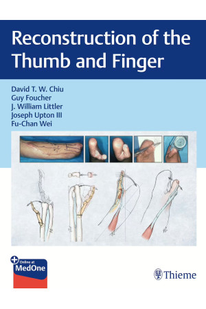 Reconstruction of the Thumb and Finger