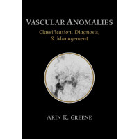 Vascular Anomalies