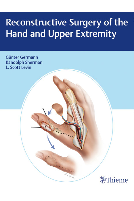 Reconstructive Surgery of the Hand and Upper Extremity