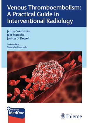 Venous Thromboembolism