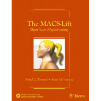 The MACS-Lift