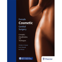 Female Cosmetic Genital Surgery