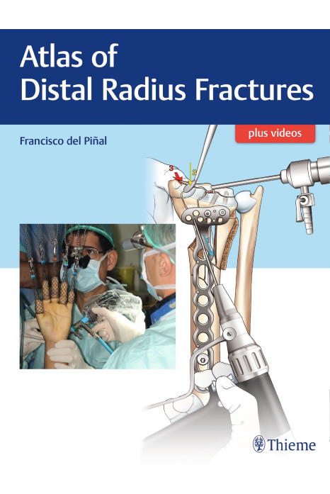 Atlas of Distal Radius Fractures