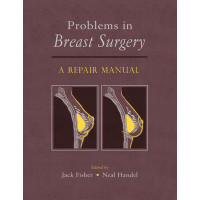 Problems in Breast Surgery