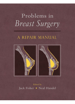 Problems in Breast Surgery