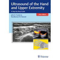 Ultrasound of the Hand and Upper Extremity