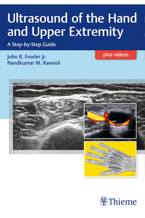 Ultrasound of the Hand and Upper Extremity