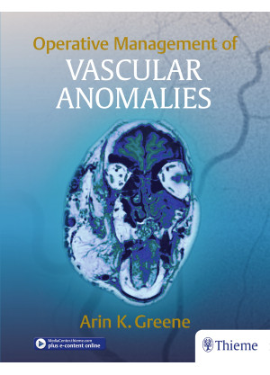 Operative Management of Vascular Anomalies