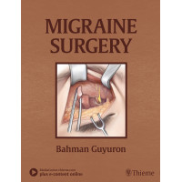 Migraine Surgery