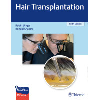 Hair Transplantation