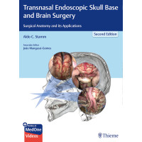 Transnasal Endoscopic Skull Base and Brain Surgery