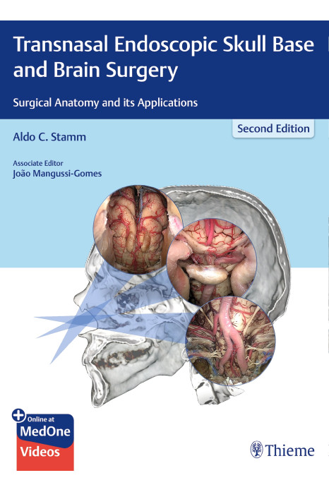 Transnasal Endoscopic Skull Base and Brain Surgery