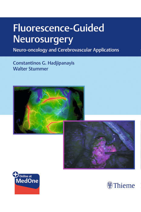 Fluorescence-Guided Neurosurgery