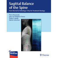 Sagittal Balance of the Spine