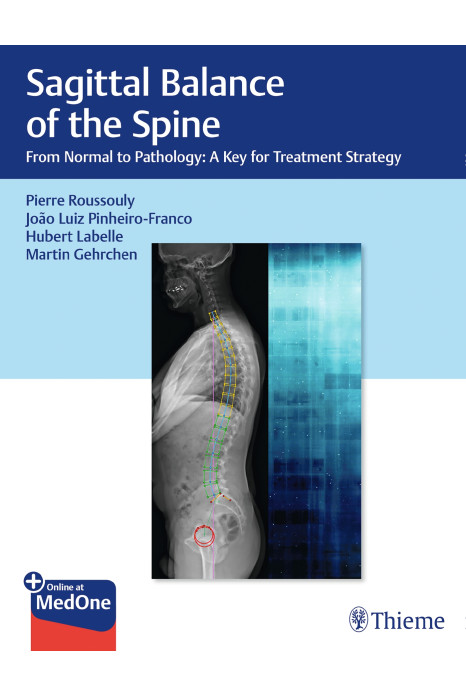 Sagittal Balance of the Spine