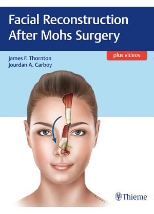 Facial Reconstruction After Mohs Surgery