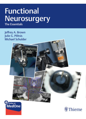 Functional Neurosurgery