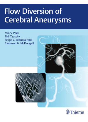 Flow Diversion of Cerebral Aneurysms