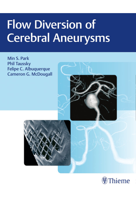 Flow Diversion of Cerebral Aneurysms