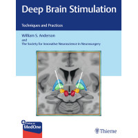 Deep Brain Stimulation