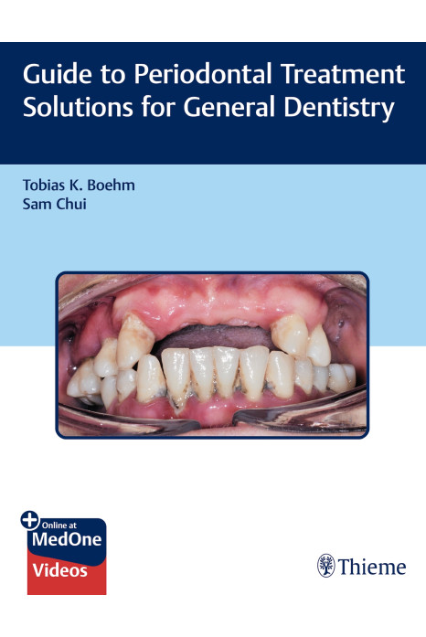 Guide to Periodontal Treatment Solutions for General Dentistry