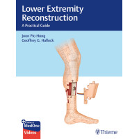 Lower Extremity Reconstruction