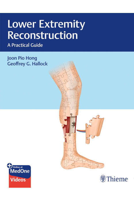 Lower Extremity Reconstruction