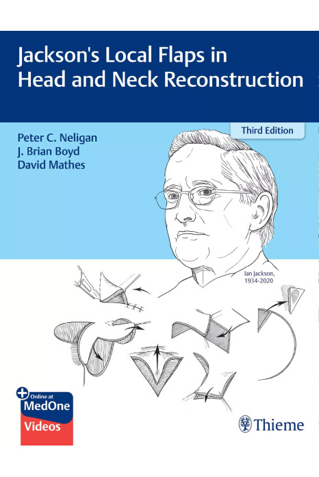 Jackson's Local Flaps in Head and Neck Reconstruction