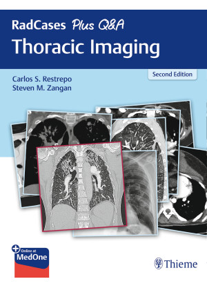 RadCases Plus Q&A Thoracic Imaging