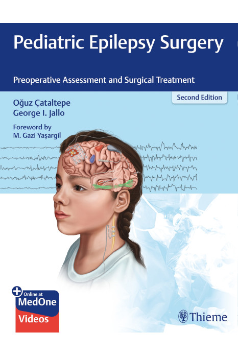 Pediatric Epilepsy Surgery