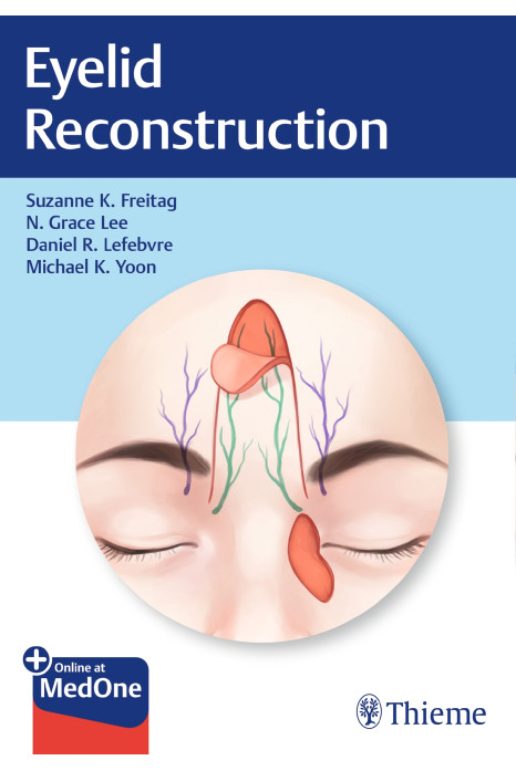 Eyelid Reconstruction