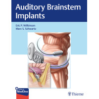 Auditory Brainstem Implants