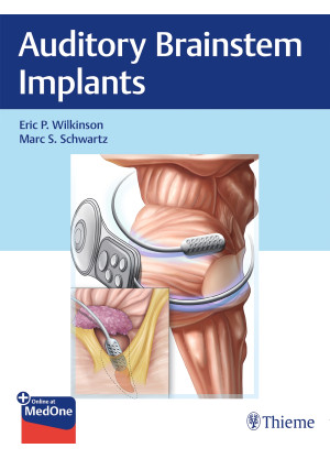 Auditory Brainstem Implants