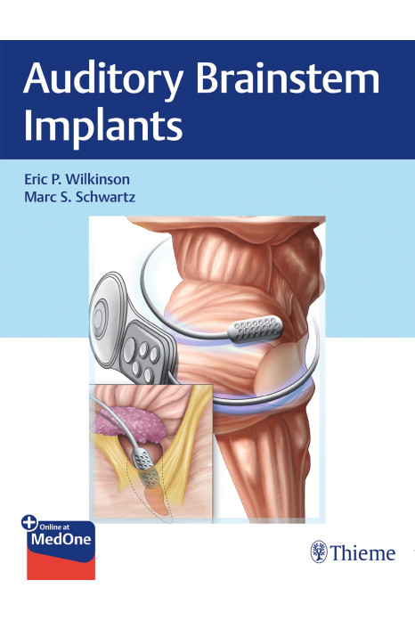 Auditory Brainstem Implants