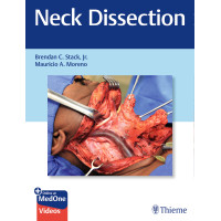 Neck Dissection