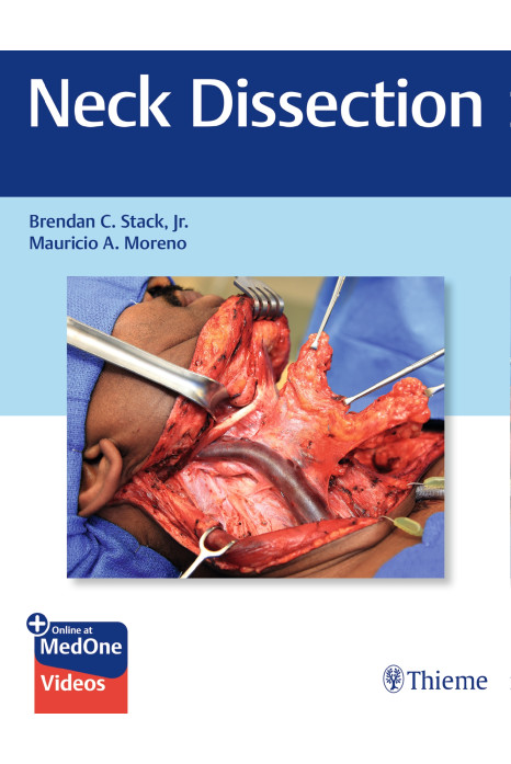 Neck Dissection