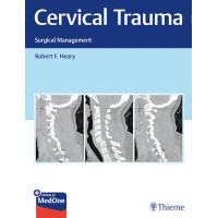 Cervical Trauma