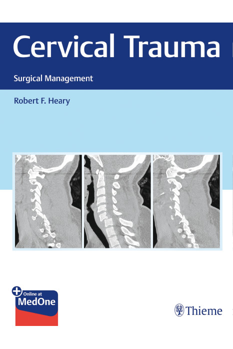 Cervical Trauma