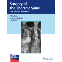 Surgery of the Thoracic Spine