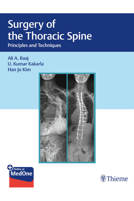 Surgery of the Thoracic Spine