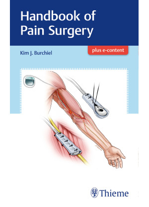 Handbook of Pain Surgery