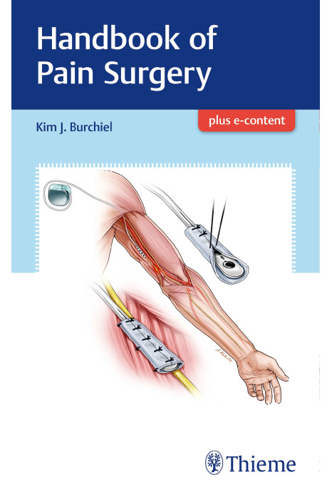 Handbook of Pain Surgery