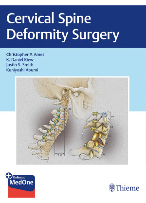 Cervical Spine Deformity Surgery