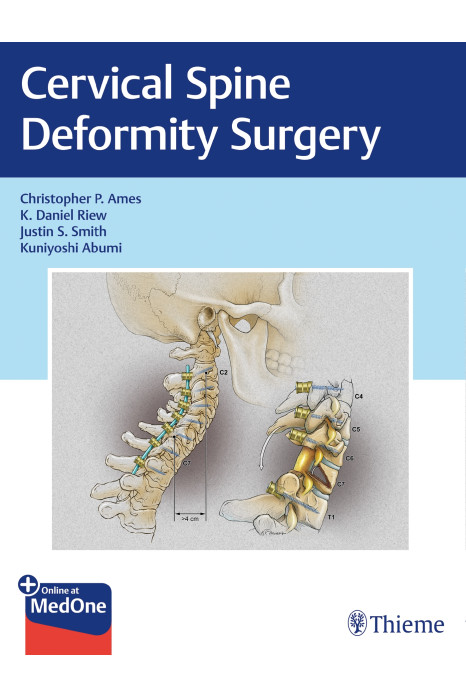 Cervical Spine Deformity Surgery