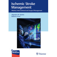 Ischemic Stroke Management