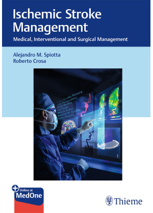 Ischemic Stroke Management