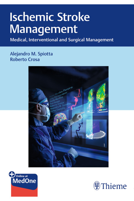 Ischemic Stroke Management