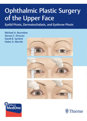 Ophthalmic Plastic Surgery of the Upper Face