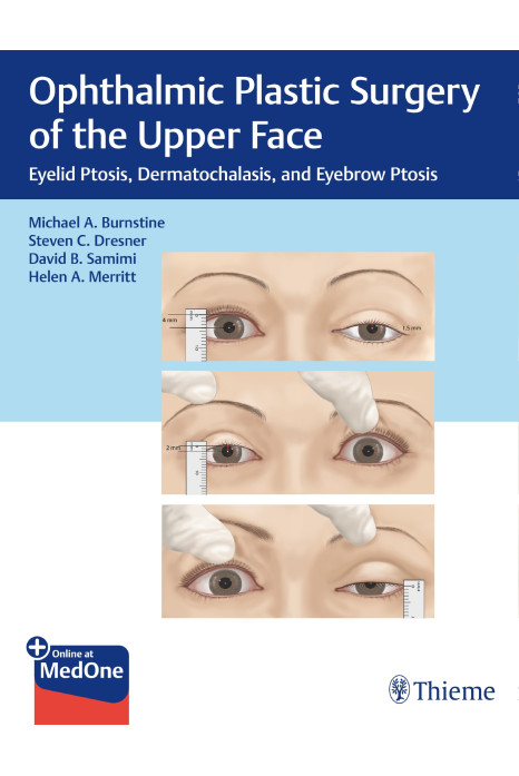 Ophthalmic Plastic Surgery of the Upper Face